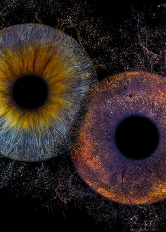 photographie d'iris humain et chien Bordeaux