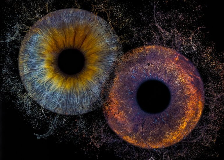 photographie d'iris humain et chien Bordeaux